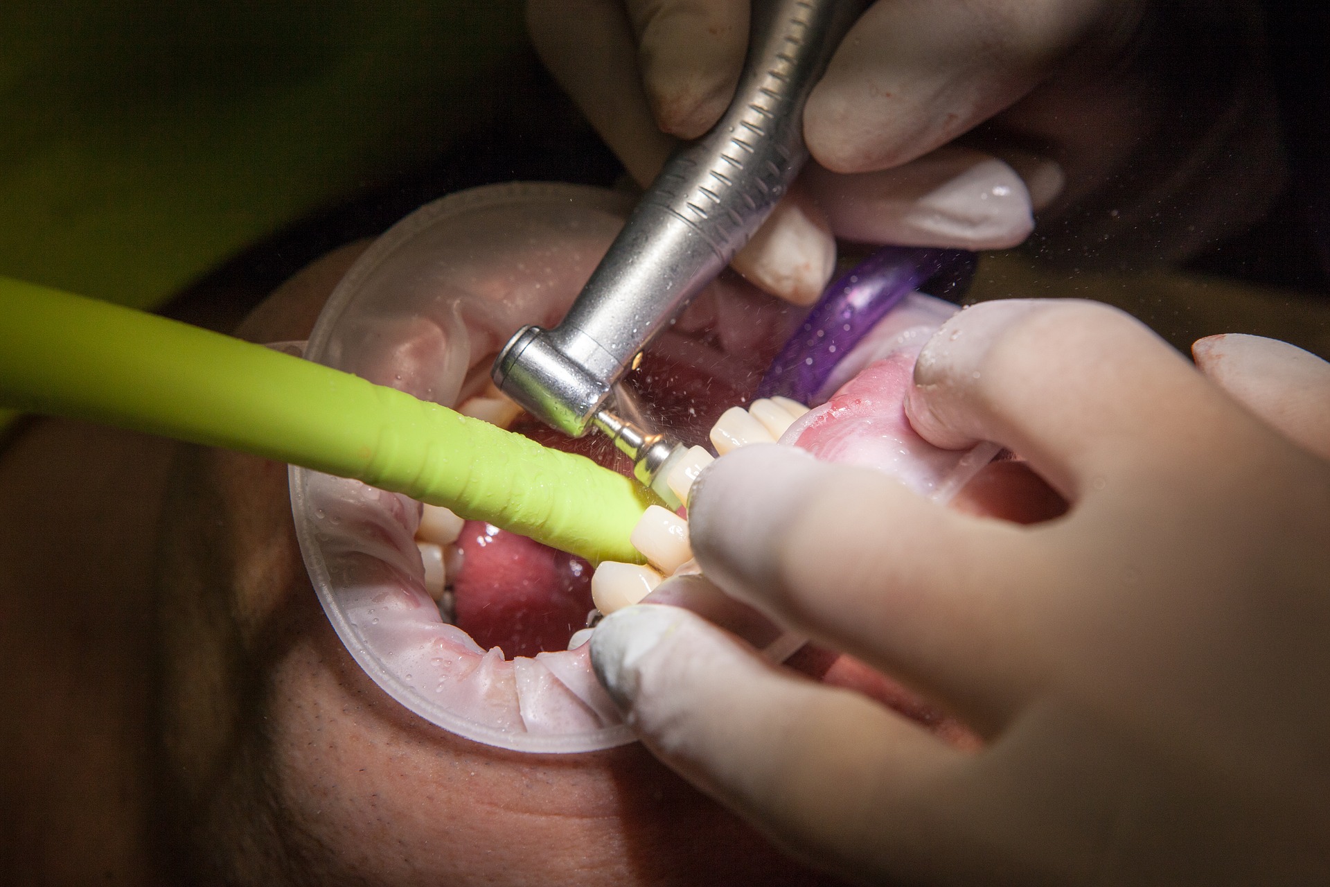 clinica dentara in Bucuresti